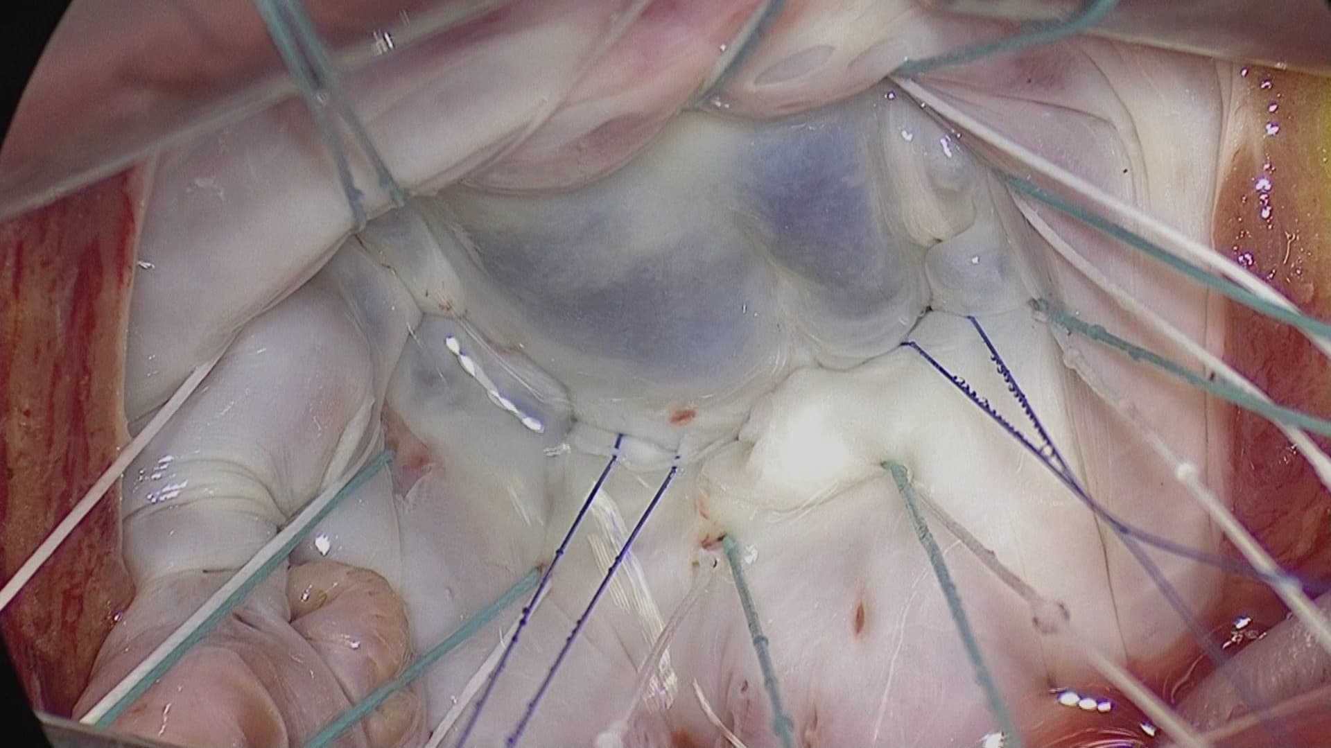 m_04042019134924_0000000012183647_1_001_0001-01.mp4_20190405_070408.752