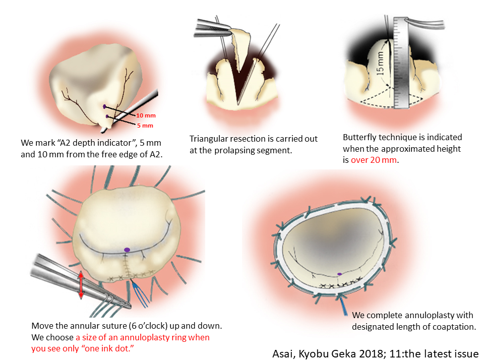 butterfly_kyobugeka_color_r